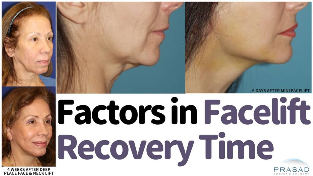 How Facelift Recovery can be Faster, Without Compromising Results or Longevity