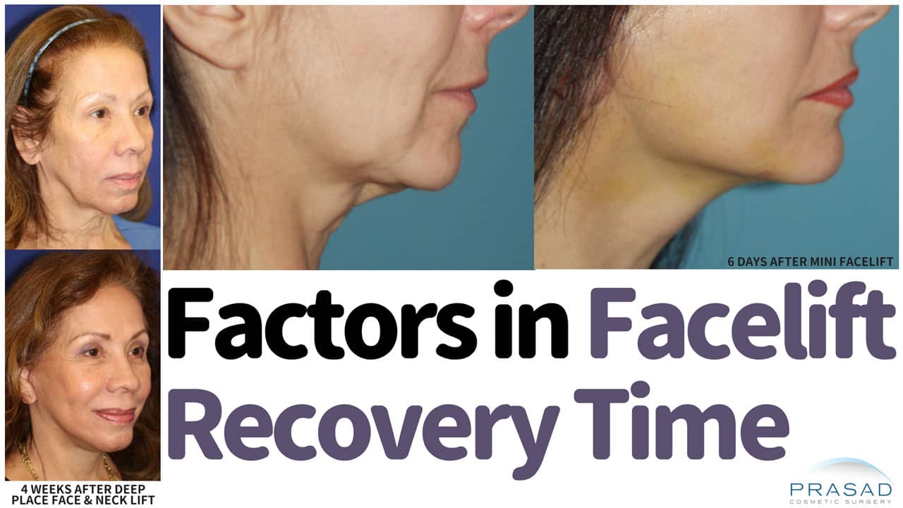 how-to-speed-up-facelift-recovery-dr-amiya-prasad-blog-new-york