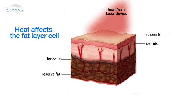 heat affects the fat layer cell illustration