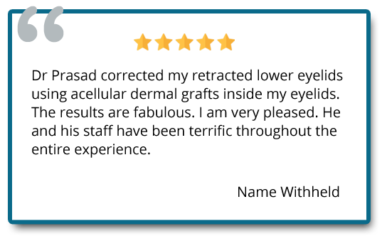 Eyelid surgery revision customer reviews "Dr. Prasad corrected my retracted lower eyelids, The results are fabulous"