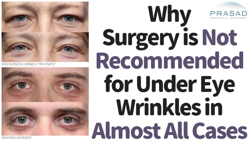 Why Under Eye Wrinkles Shouldn't be Treated with Surgery in Almost All Cases