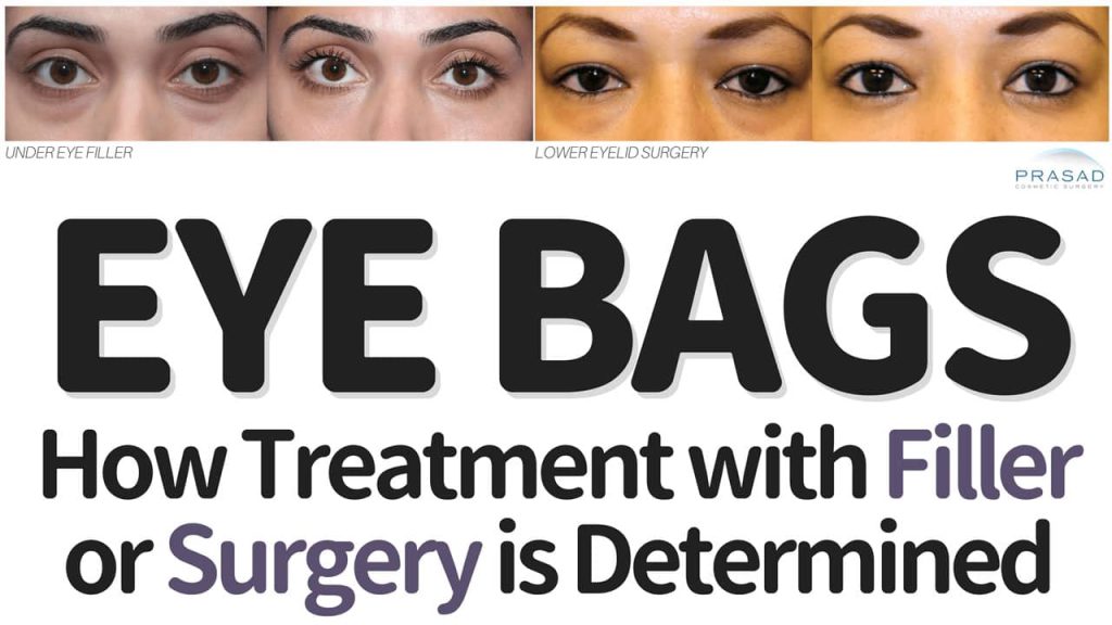 how eye bag treatment is determined with surgery or filler