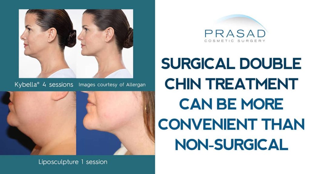 double chin treatment surgical vs non-surgical