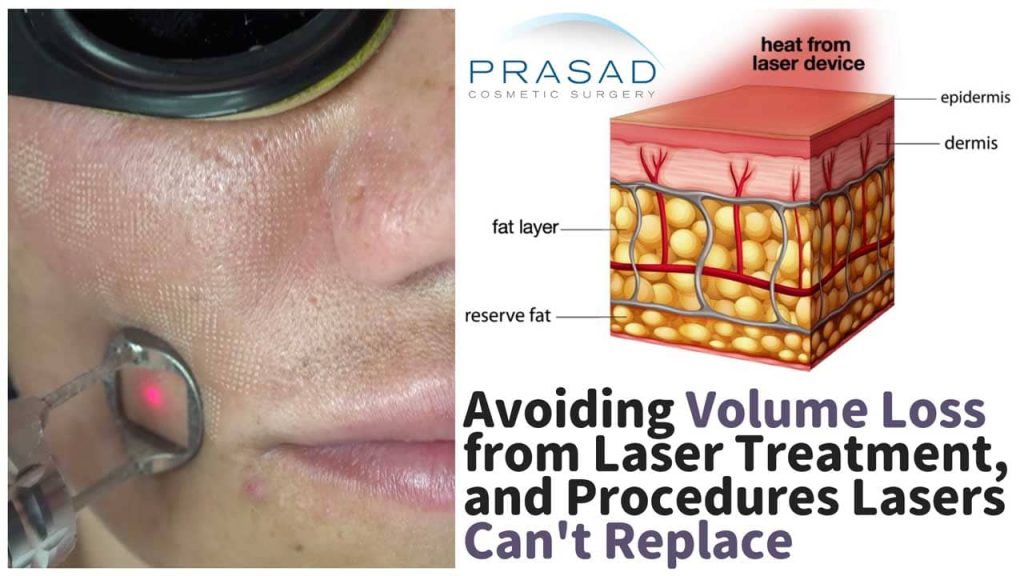 avoiding volume loss from laser treatment