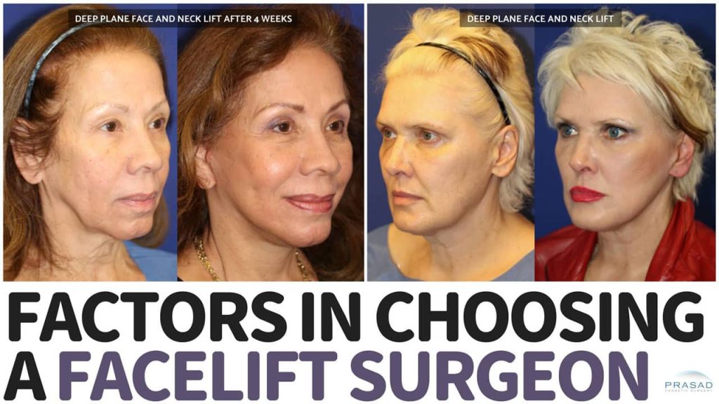 factors in choosing a facelift surgeon