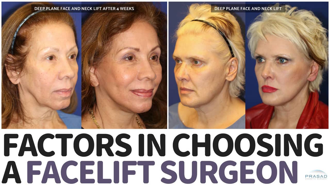 How to Find the Best Facelift Surgeon The Factors to Consider