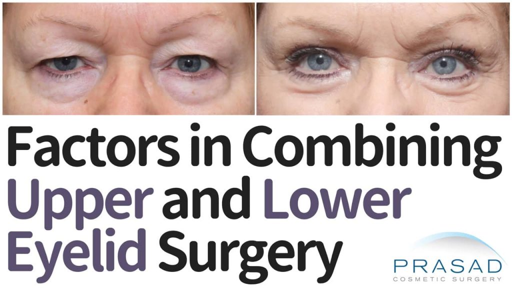 factors in combining upper and lower eyelid surgery done at the same time