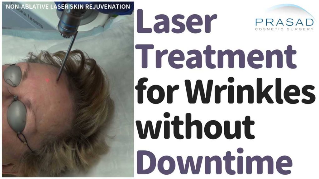 laser treatment for wrinkles without downtime