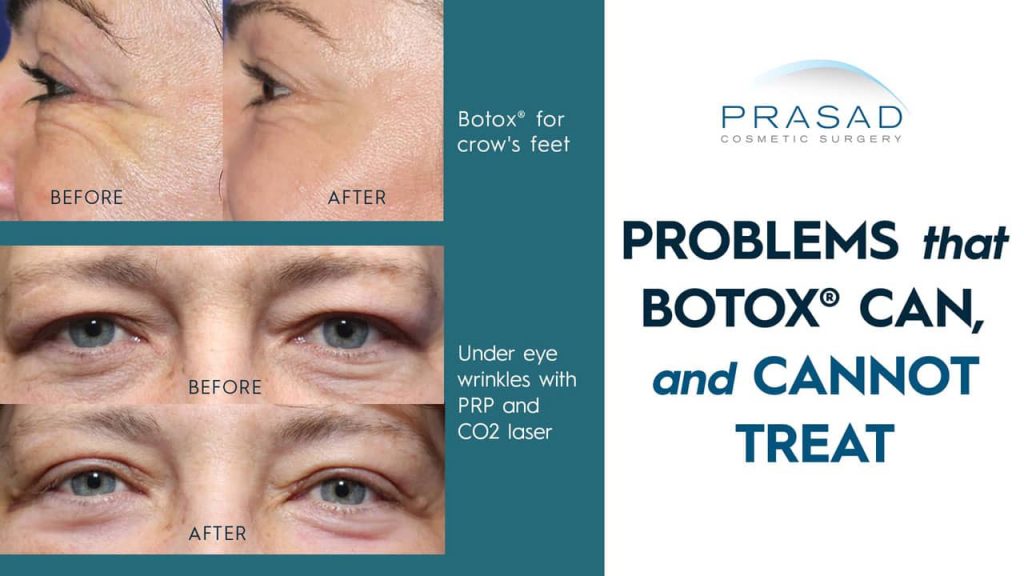 problems that Botox can and cannot treat