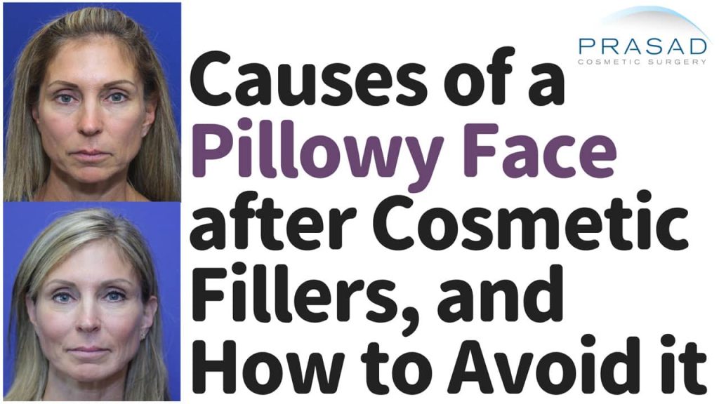 Causes of pillowy face after cosmetic fillers and how to avoid it