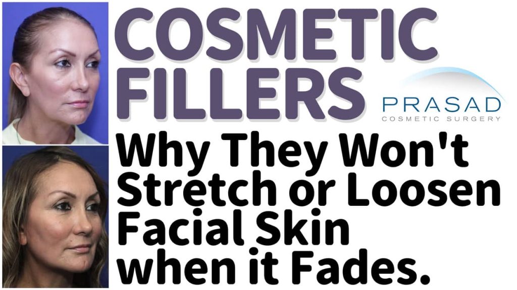 cosmetic filler why they wont stretch or loosen facial skin