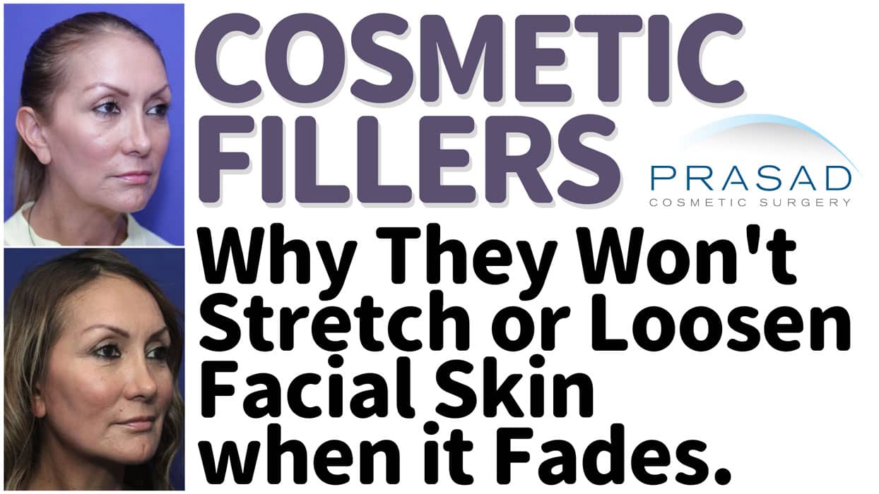 Do Fillers Ruin Your Face As They Lose Their Effect?