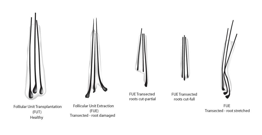 fut fue hair strands illustration