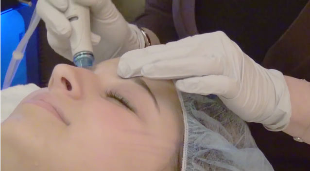 hydrafacial for skin rejuvenation and hyperpigmentation treatment