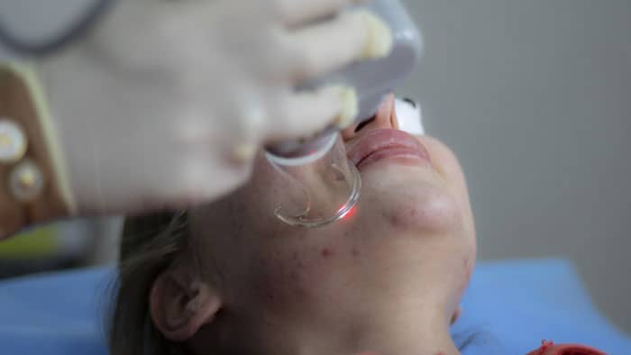 woman receiving laser skin treatment