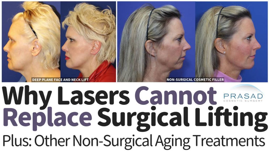 why facial laser treatment cannot replace surgical facelift