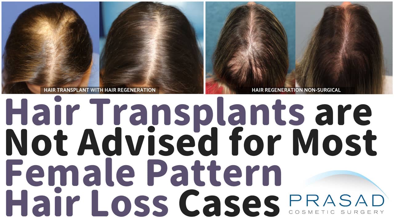 When Women Can Have a Hair Transplant? | Dr. Prasad Blog