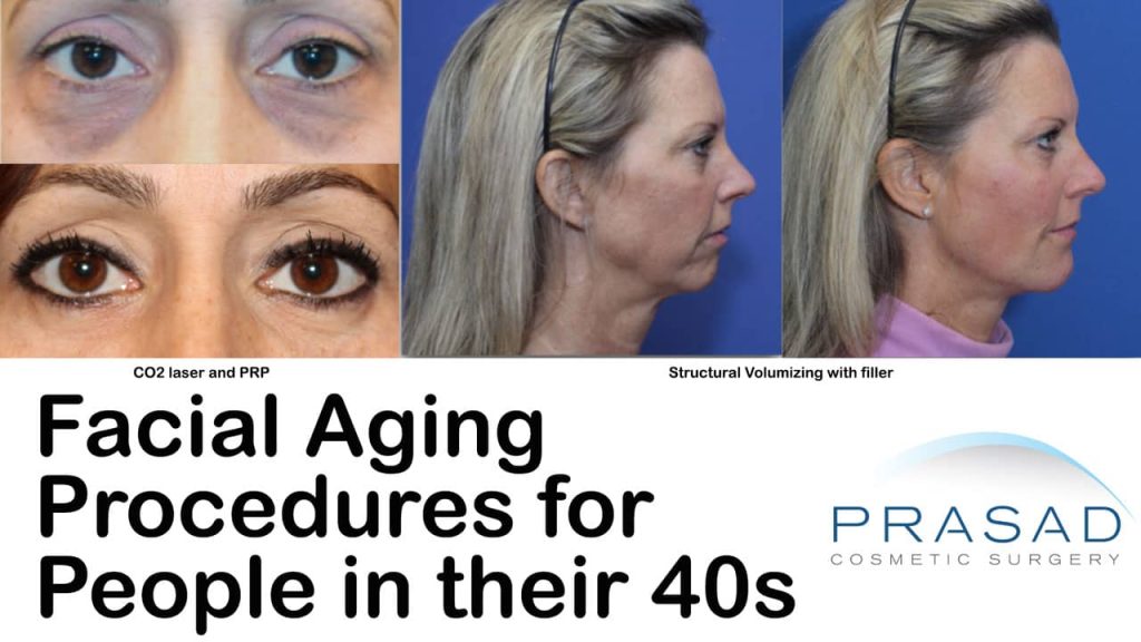 facial aging procedures for people in their 40s