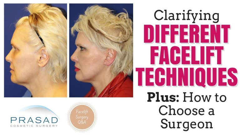 clarifying-different-facelift-techniques-plus-how-to-choose-a-surgeon