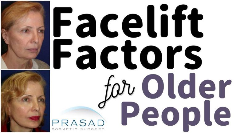 facelift factors for older people