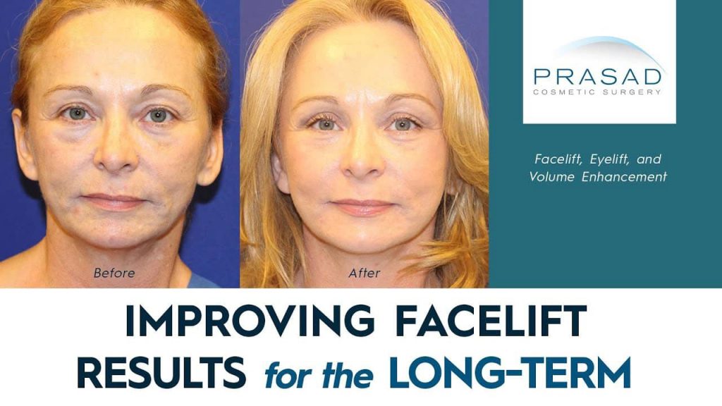 Improving facelift results for the long term