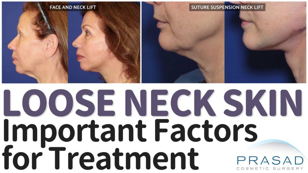 how to tighten loose neck skin - important factors for treatment