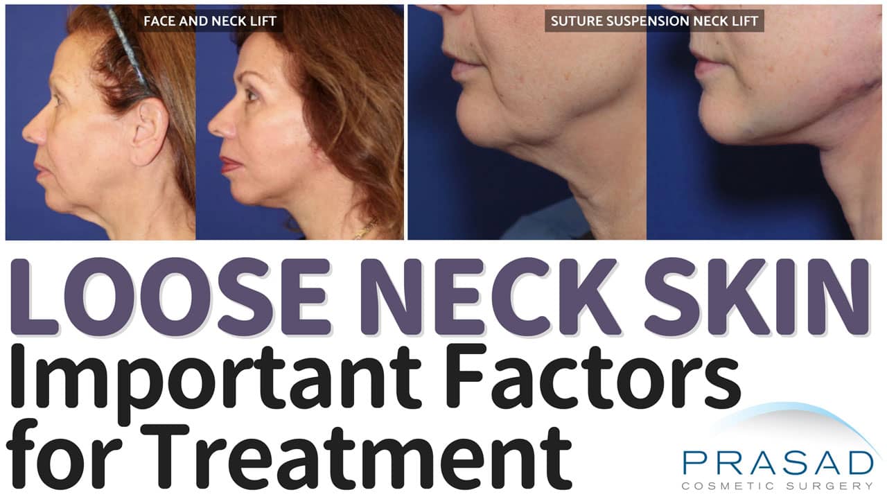 How To Tighten Neck Skin Surgical And Non Surgical Options