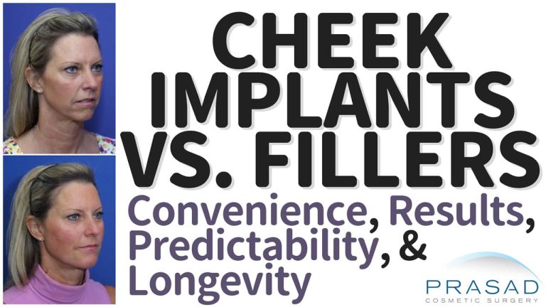 cheek implants vs fillers: convenience, results, predictability, and longevity