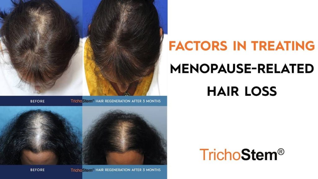 factors in treating hair loss due to menopause