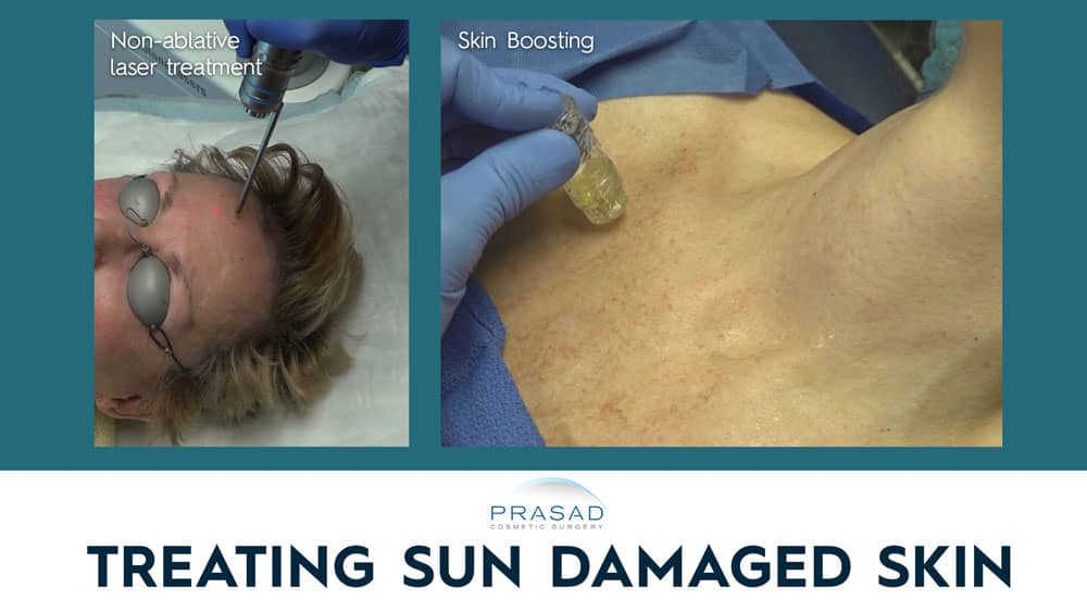 treating sun damaged skin