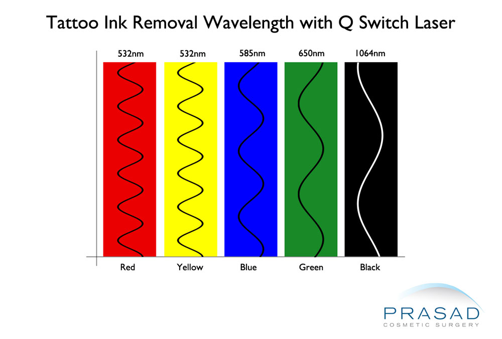 tattoo ink removal wavelength illustration