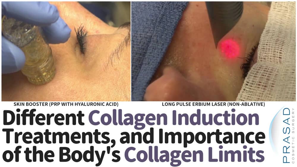different collagen induction treatment