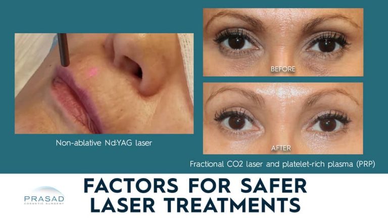 laser treatment for wrinkles and under eyes with the text Factors for Safer Laser Treatments