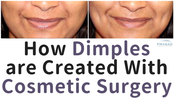 how dimples are created with cosmetic surgery