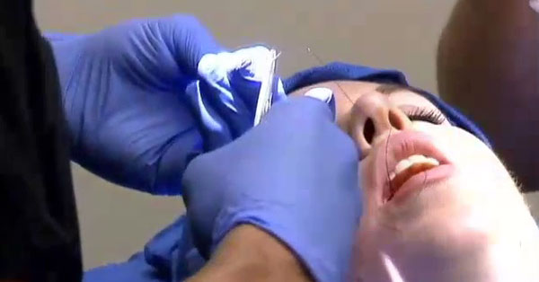 patient under dimpleplasty procedure
