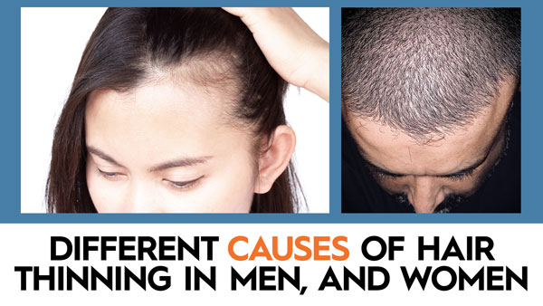 different causes of hair thinning in men and women