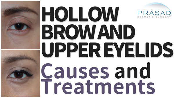 hollow brow and upper eyelids causes and treatments