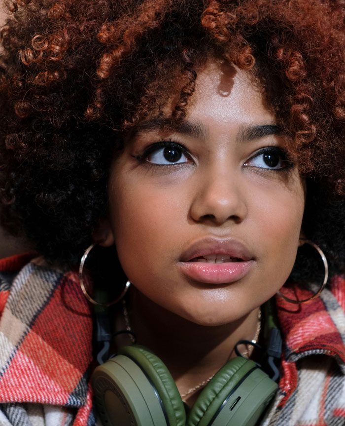 young woman with eye bags