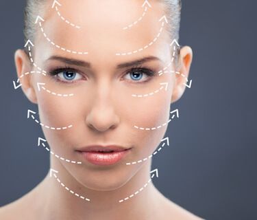 Facelift illustration-Prasad Cosmetic