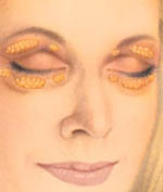 illustration of eyelid fat pockets
